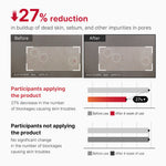بخّاخ Medicube Red Acne Body Peeling لتقشير وعلاج حب الشباب فى الجسم — ١١٠ مل