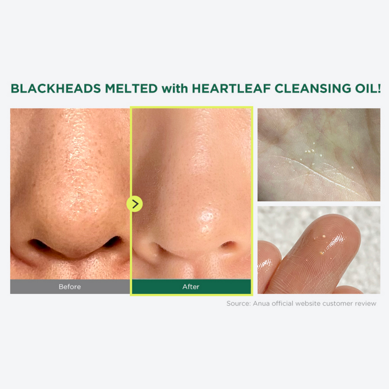 زيت تنظيف Anua Heartleaf للمسامات والرؤوس السوداء — ٢٠٠ مل — صورة 5 — كنوز الكويت